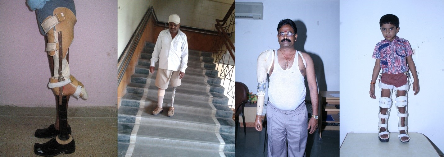 fitment of prostheses & orthoses